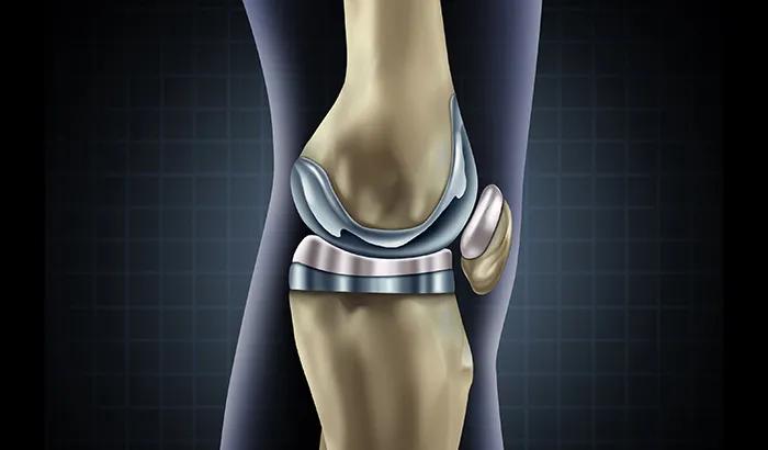 冬天腿关节膝盖疼有什么妙方,天冷膝盖疼是怎么回事是老寒腿吗