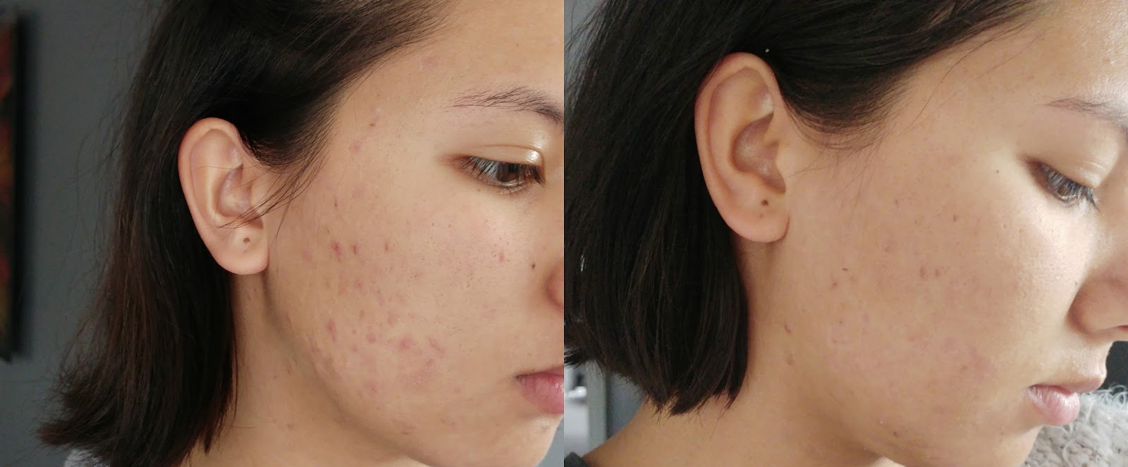 澳洲kosmea玫瑰果油,蔻诗美玫瑰果油敏感肌