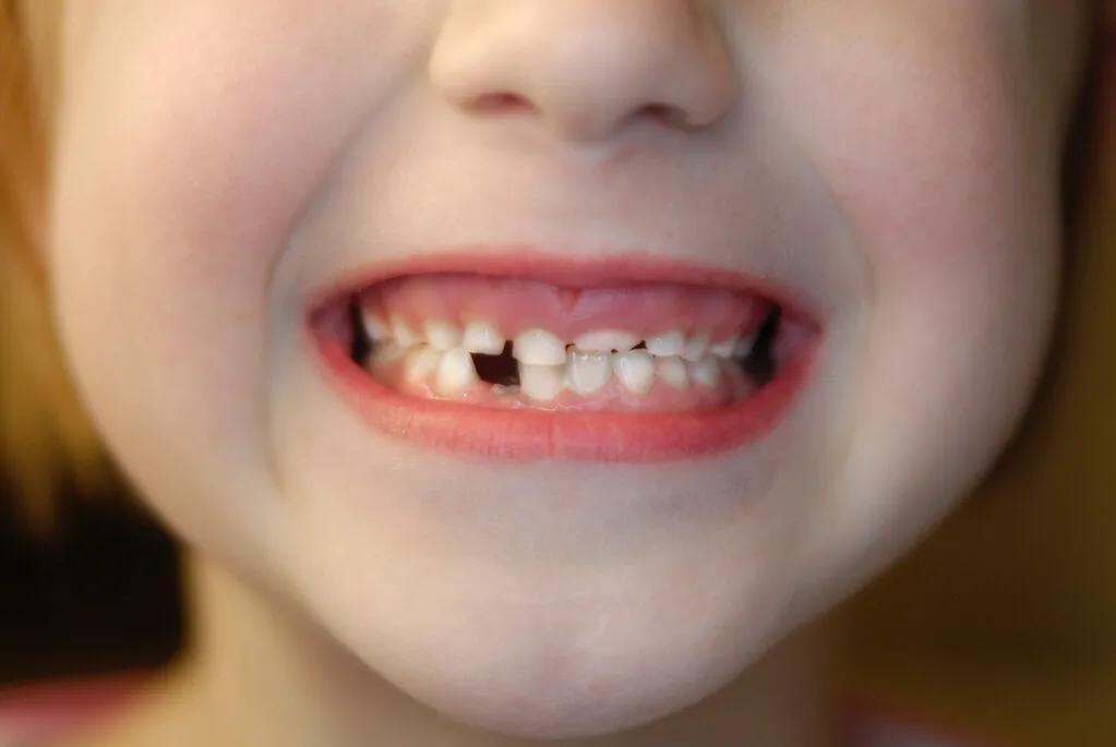 哺乳动物和人类一样换牙吗,什么哺乳动物会换两次牙