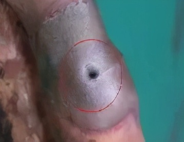 焊接铜管漏氟,焊接铜管出现瘤子