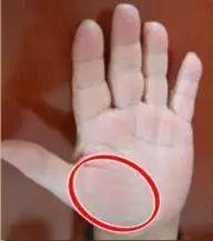 手诊10种常见病从手上就能看出来,手上健康的秘密