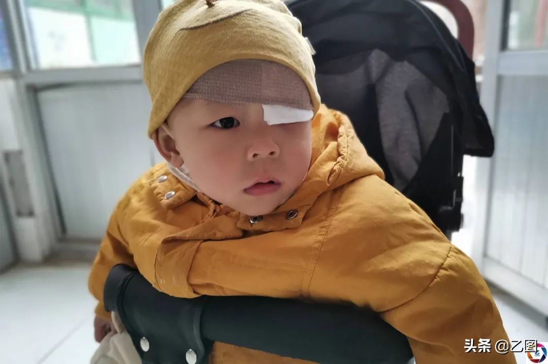 世上最悲催的婴儿,人间悲惨的孩子