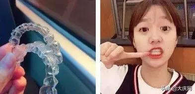 花了18000的牙齿矫正划不划算,牙齿矫正8000重庆