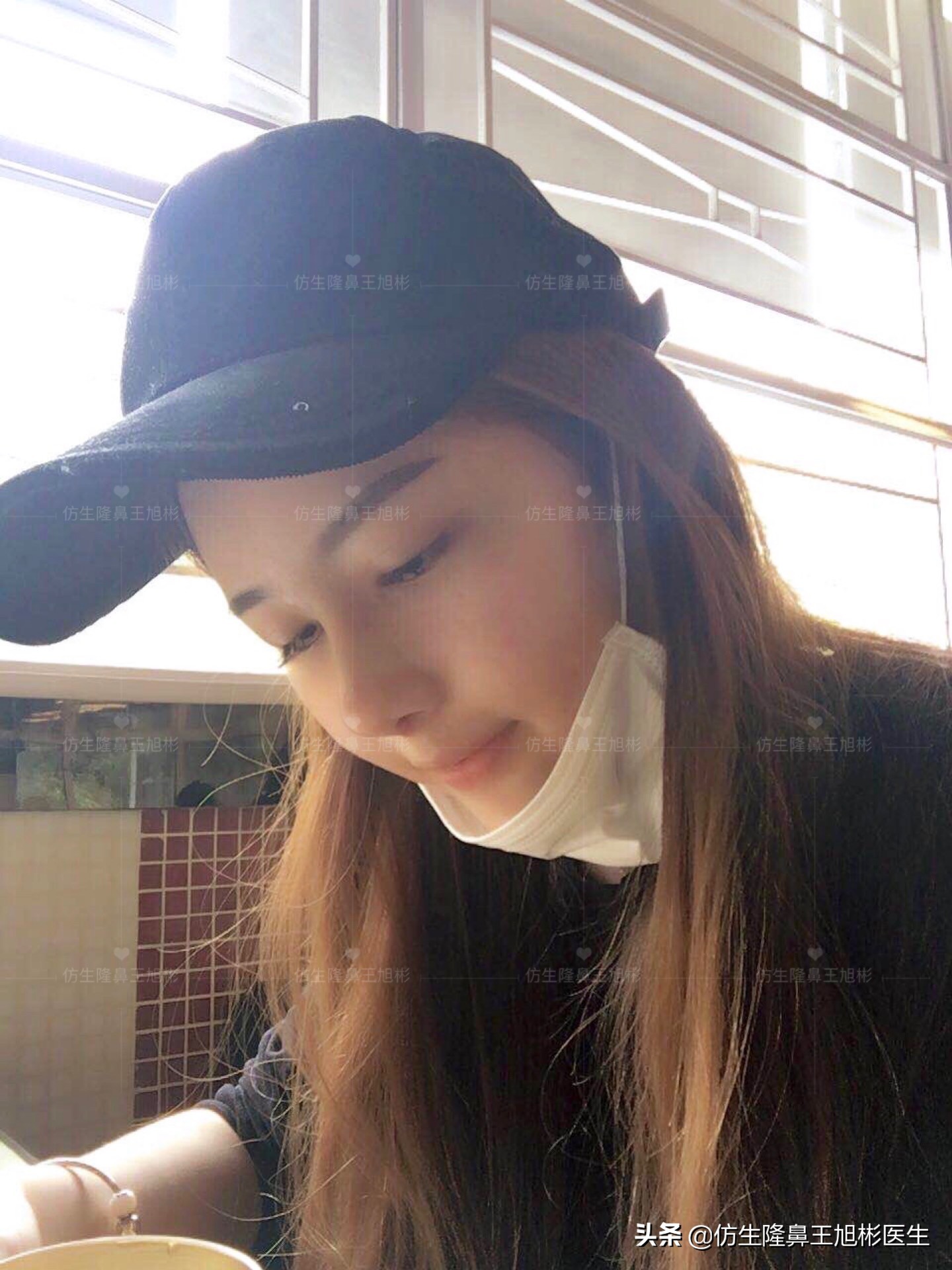 最安全的隆鼻方法,隆鼻的方法有几种及各自的优缺点