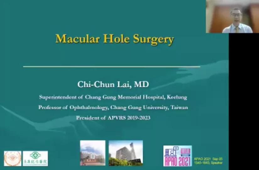 视网膜裂孔未来有希望痊愈,眼底黄斑裂孔能治愈吗最新消息