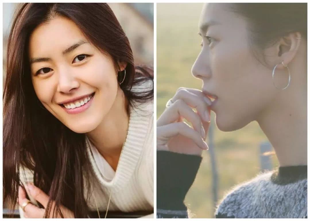 微整的真实效果,微整蜕变过程