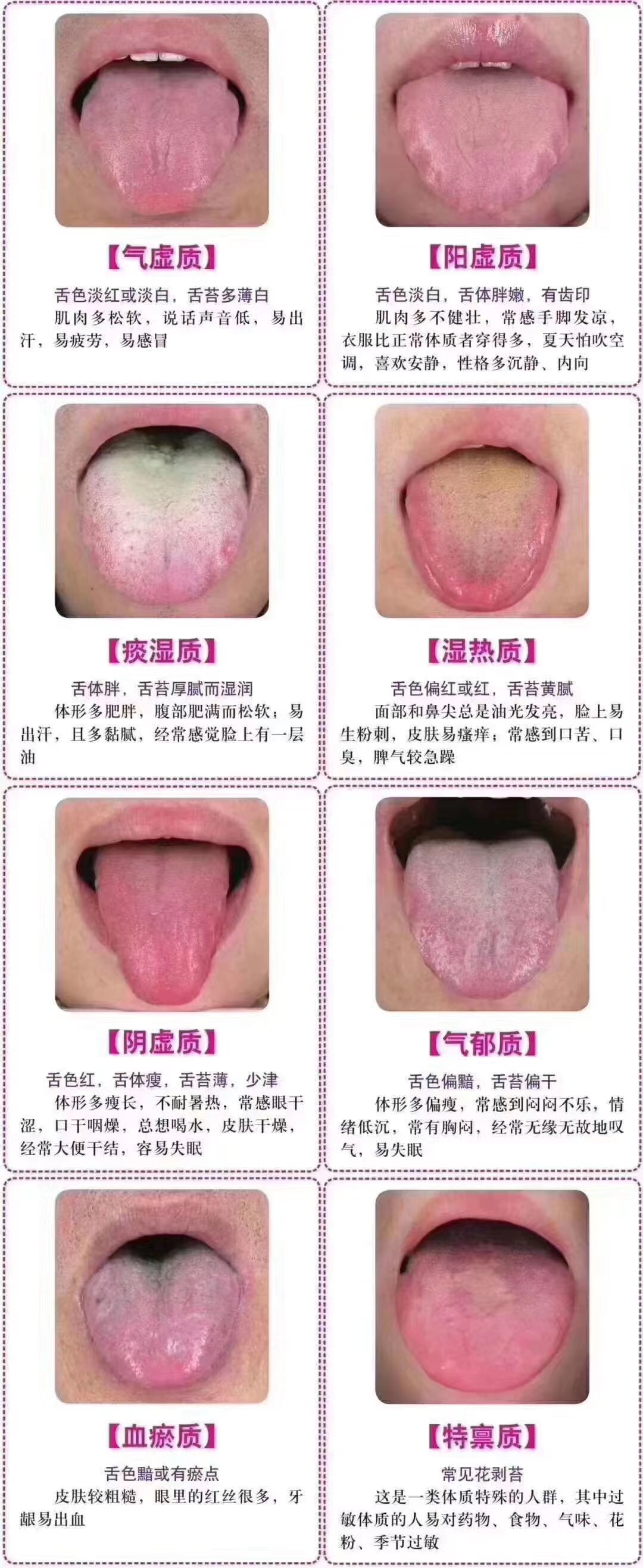 看看你的舌头是怎么变化的,看看你的舌头就知道你有没有病