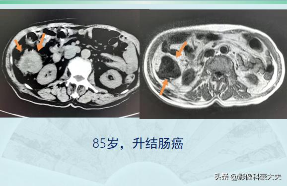 老人去世送盘缠是什么意思,老人去世送盘缠怎么说