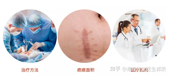 做增生疤痕疙瘩去除手术费用,凹陷性疤痕和普通疤痕治疗费用