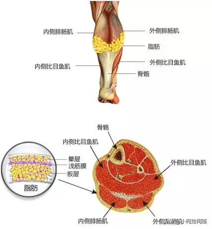 跑步机跑步会不会使小腿变粗,跑步小腿变粗的原因及解决方法