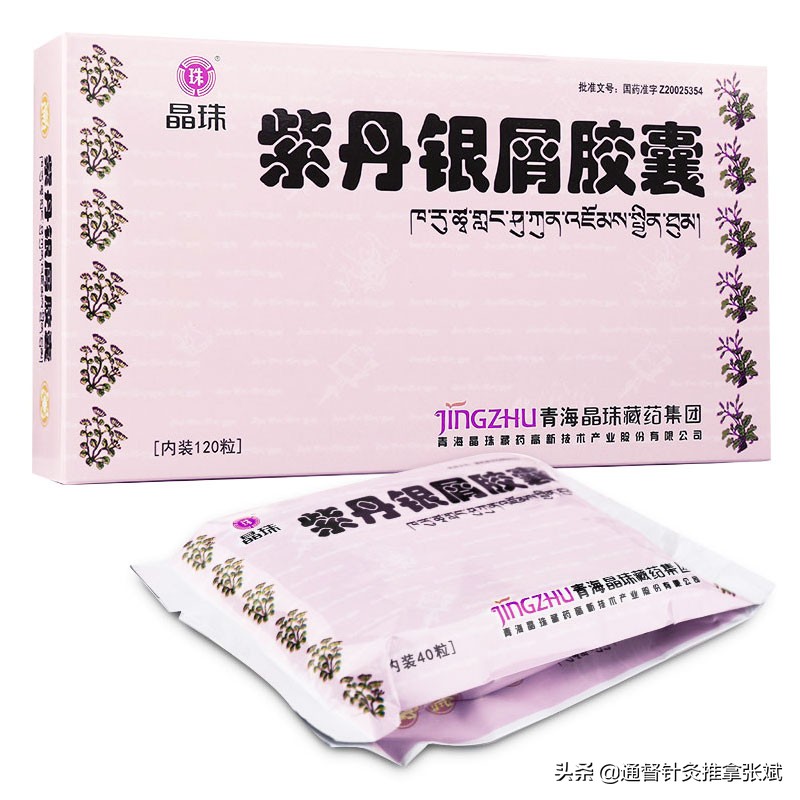 牛皮癣中成药哪种好,牛皮癣中药治疗案例