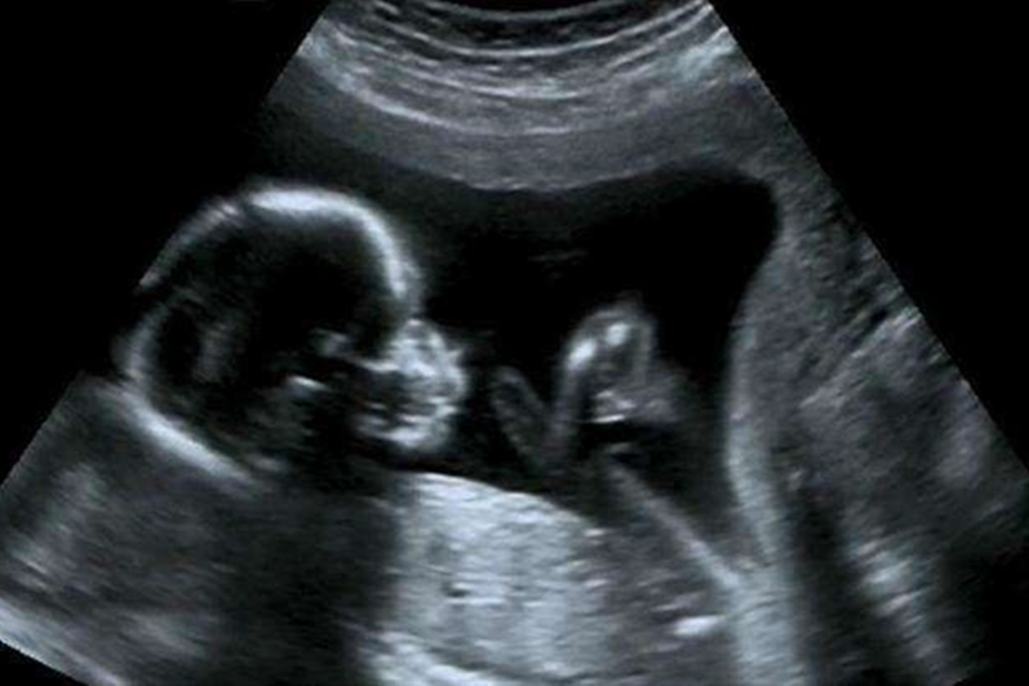 胎儿的性别是几周形成的,胎儿的性别是在什么时候形成的