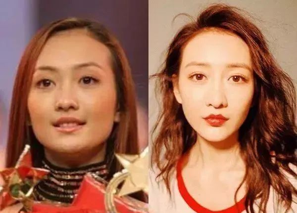 男子整容后从此走上人生巅峰,24岁小伙整容失败变大叔