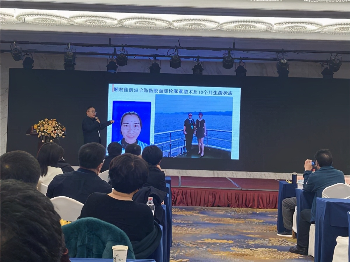 脂肪整形学术峰会,郭同荣吸脂失败案例