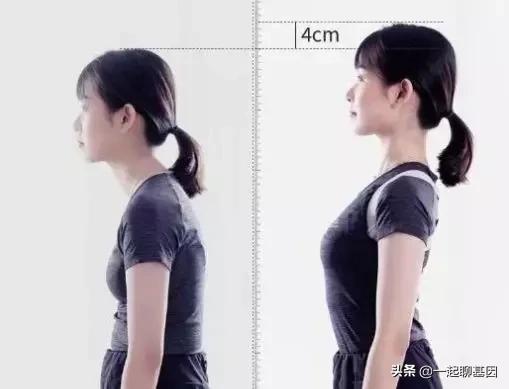 驼背如何矫正最快最有效方法,驼背怎么办最有效的方法