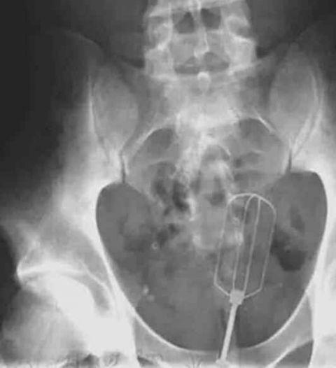 不作死就不会死看看你中了几条,不作死就不会死让人看的头皮发麻