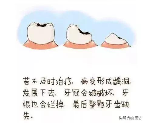 牙龈萎缩牙齿松动中医有什么方法,牙齿松动怎么办教你一招恢复