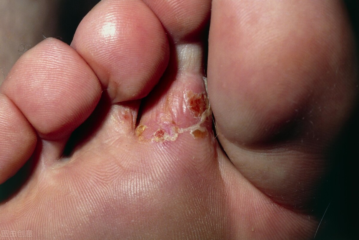 8种常见皮肤问题如何预防与治疗,9种日常小妙招帮你解决皮肤问题