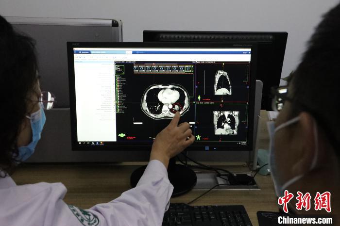 中国癌症研究基地在哪,碳离子治疗癌症