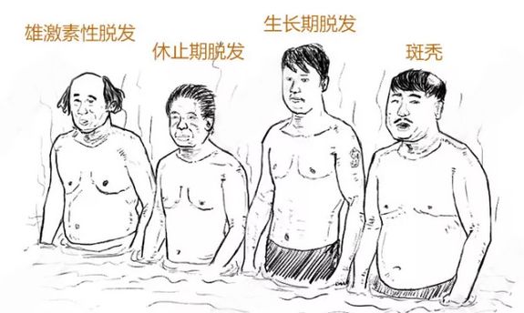 美女主持人突然上热搜，网友纷纷晒同款！脱发原来是毛囊“休息”了