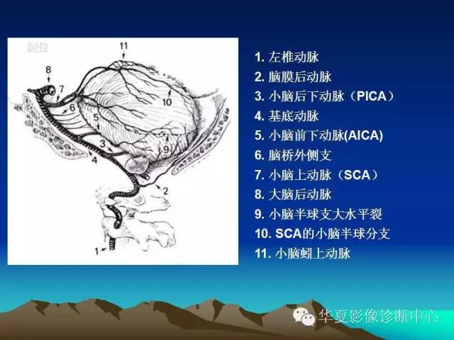 小脑血管解剖分段,脑血管影像解剖讲解