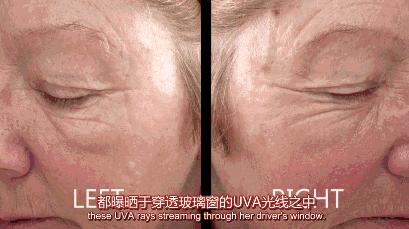 大s告诉你皮肤干燥,大s说美白