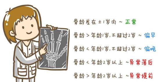 梅西生长性激素缺失,梅西真实身高不到1米6