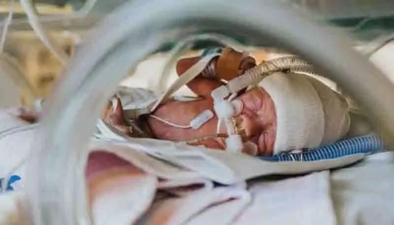 心疼!出生2天早产儿腹胀如包子生命垂危,医生打开腹...