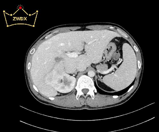 紫薇帝星穴,紫薇帝星医疗科技