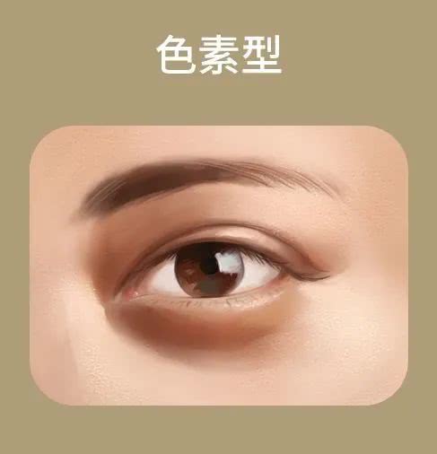 黑眼圈的原因以及解决办法,黑眼圈最近越来越严重怎么解决