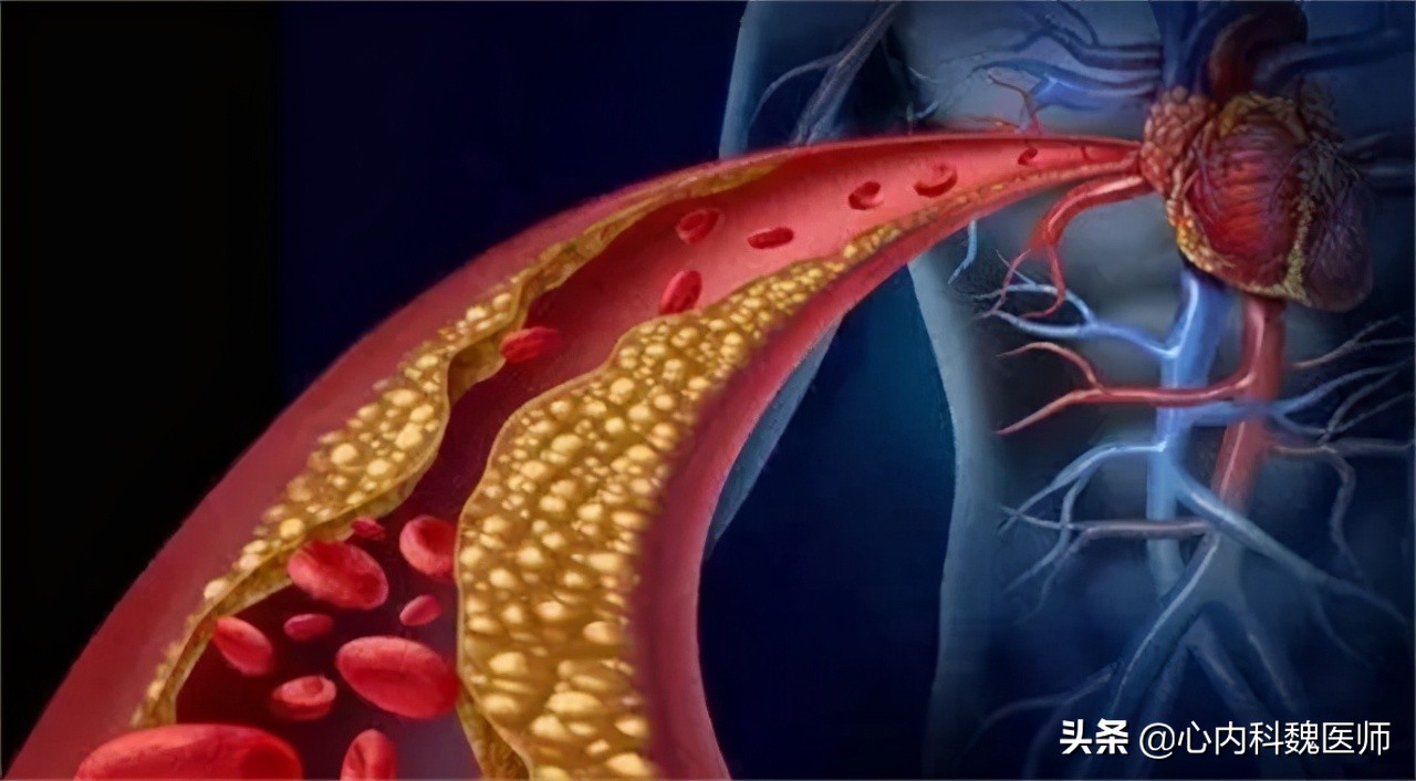 猪油吃多了对心脑血管有什么危害,吃猪油对心脑血管有害吗视频