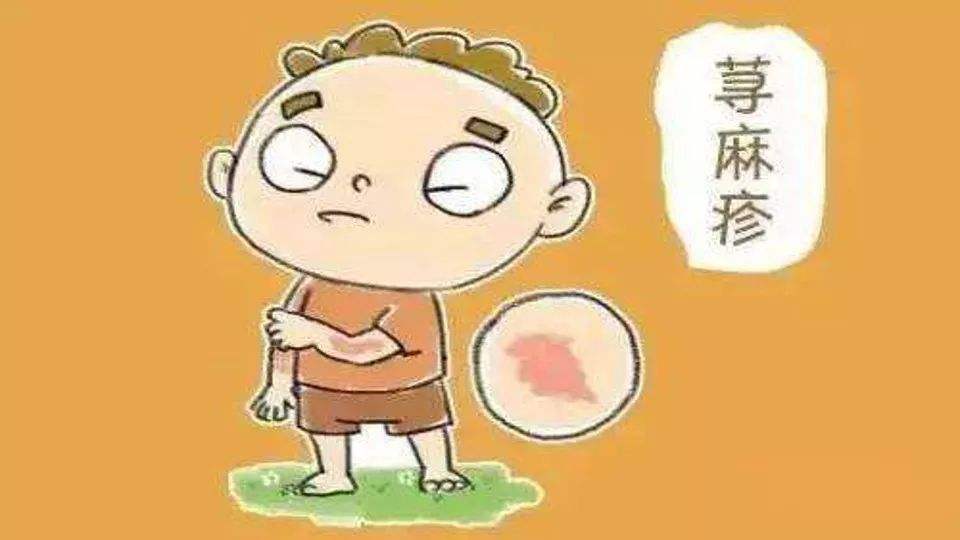 荨麻疹中医治疗病例,长春单氏中医治荨麻疹