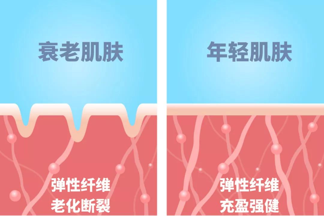 眼纹小熨斗,淡化眼纹小熨斗