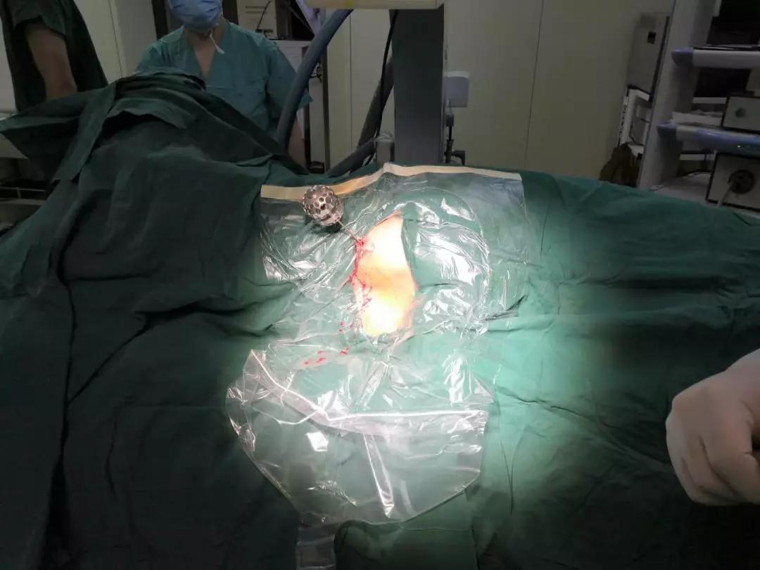 疫情防控中西医协同机制,石家庄藁城疫情防控最新措施