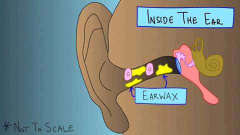 医院怎么给小朋友清理耳屎,孩子多久需要去一次医院清理耳屎