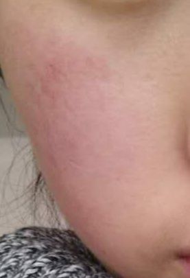 敏感肌适合的洗面奶乳液,适合红血丝皮肤的乳液