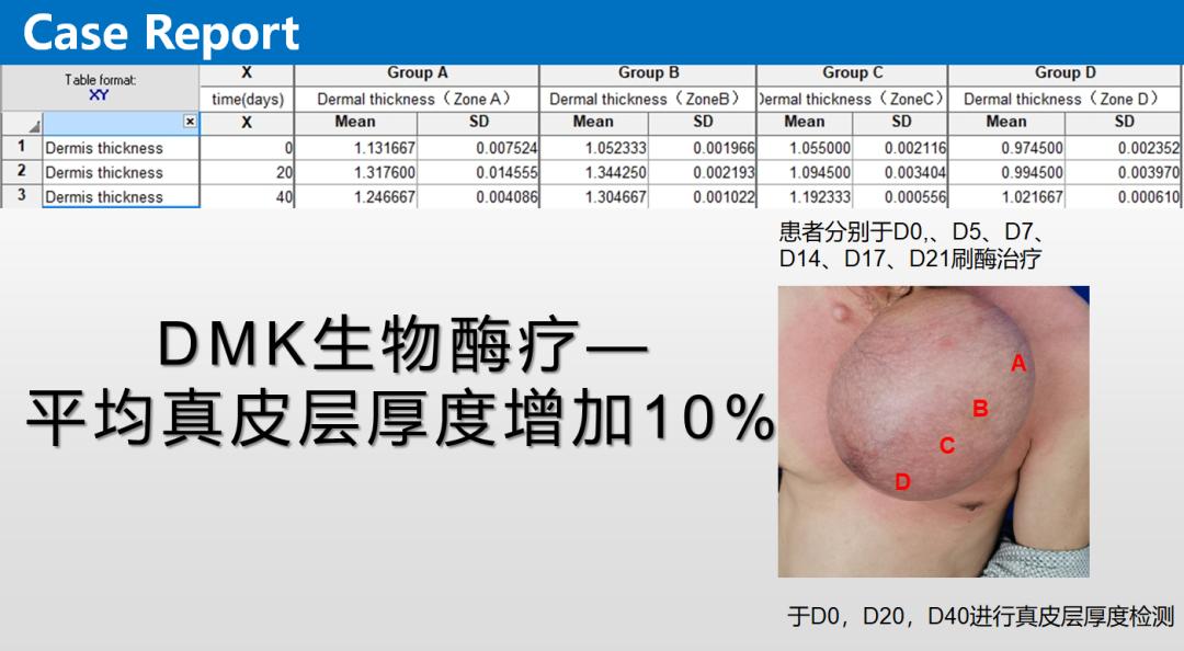 dmk生物酶疗效果怎么样,DMK生物酶疗会出现什么效应