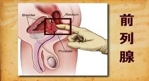 慢性前列腺炎怎么治疗最有效果,慢性前列腺炎可以彻底治愈吗知乎