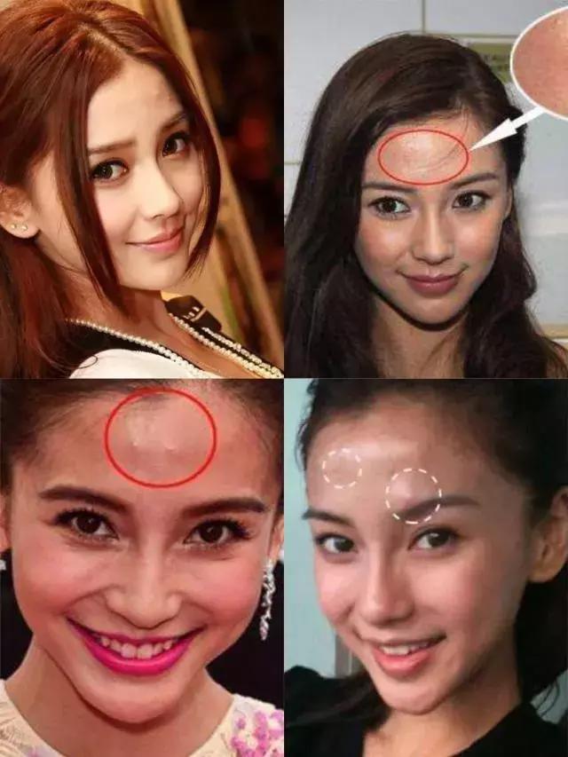 祛痘好物分享朋友圈怎么发,祛痘好物分享小学生