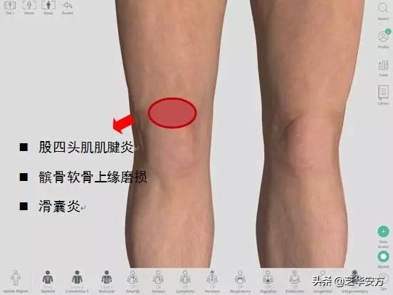 跑姿不对造成的膝盖疼多久能好,膝盖不同位置疼痛代表什么