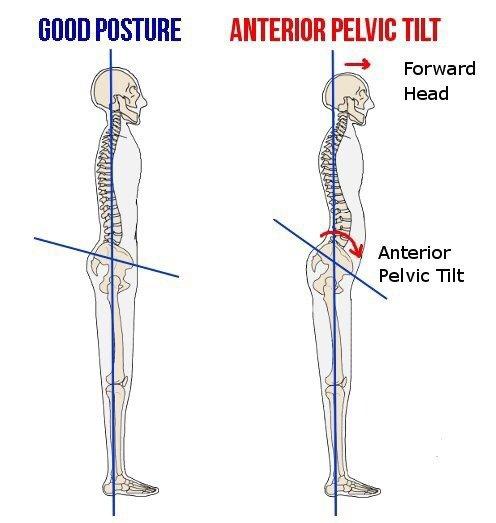 小肚腩凸起，教你解决3个问题，告别小肚腩，拥有平坦小腹