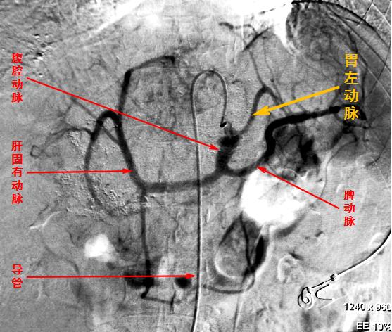 想吃却吃不下饭怎么办,想吃又不能吃怎么办