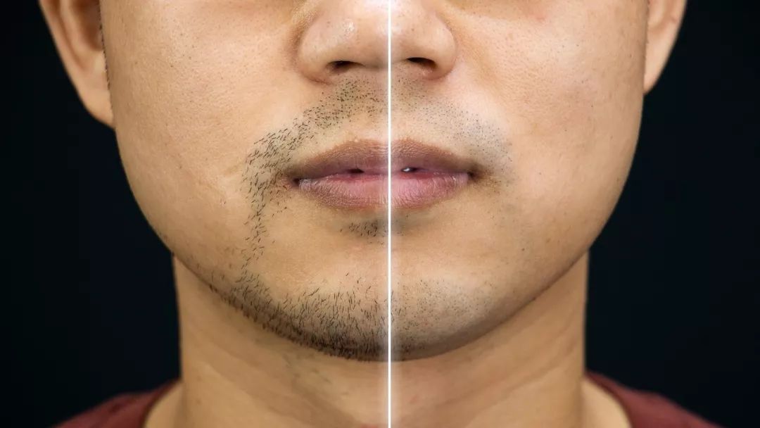 飞利浦s9000剃须刀刀头怎么拆开,飞利浦s9000剃须刀怎么连接蓝牙