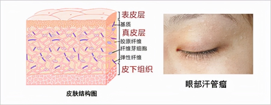 美白、刷酸都解决不了的皮肤问题，只能这么做了