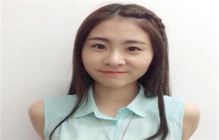 张碧晨鼻子怎么了,张碧晨鼻子怎么那么难看