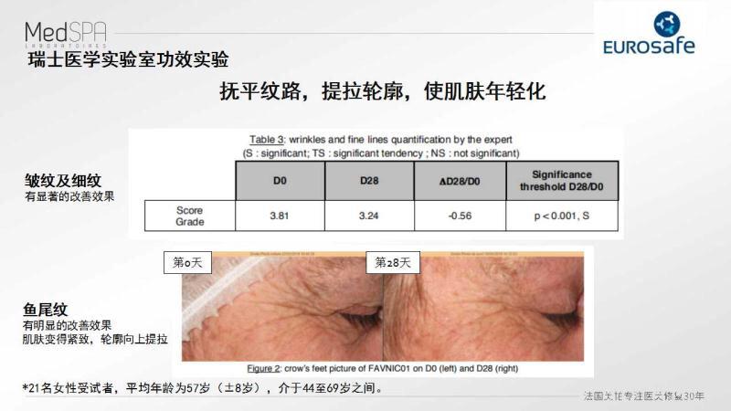 美帕涂抹型肉毒素精华液,美帕抗老精华