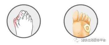 这种女人身姿婀娜，却暗藏危机！接连到沈医附属中心医院就诊…