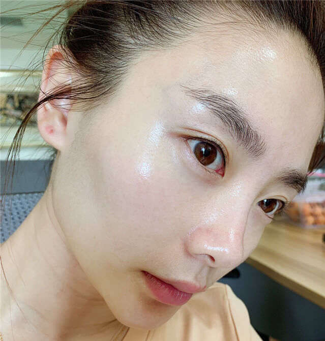 脸上闭口粉刺怎么消除,脸上闭口粉刺怎么办