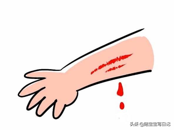 孩子被狗咬伤了该怎么办,孩子被狗咬伤要怎么办