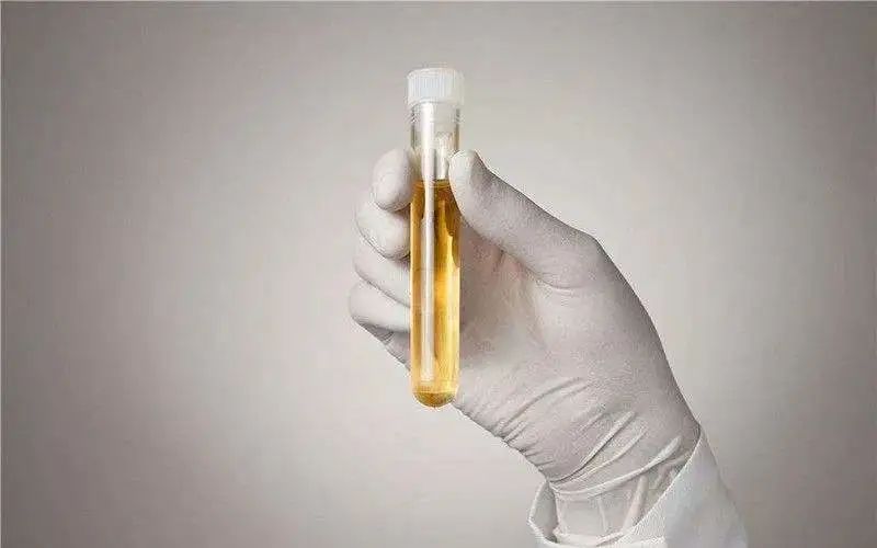 尿蛋白3是多久形成的,尿蛋白是什么原因形成的呀